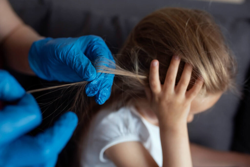 Ma fille perd ses cheveux par poignée : causes, solutions et quand consulter 3