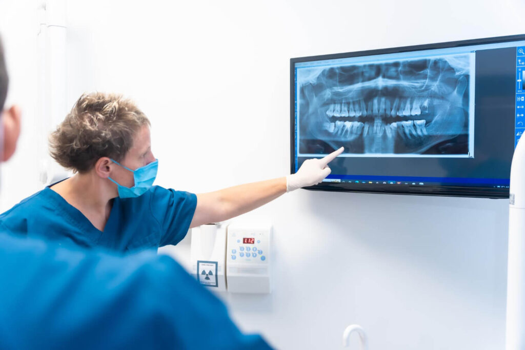 Radiographie dentaire montrant un implant avec couronne - urgence dentaire