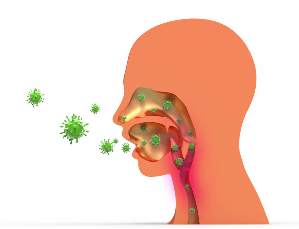 Illustration médicale des voies respiratoires et digestives - vomissements nasaux