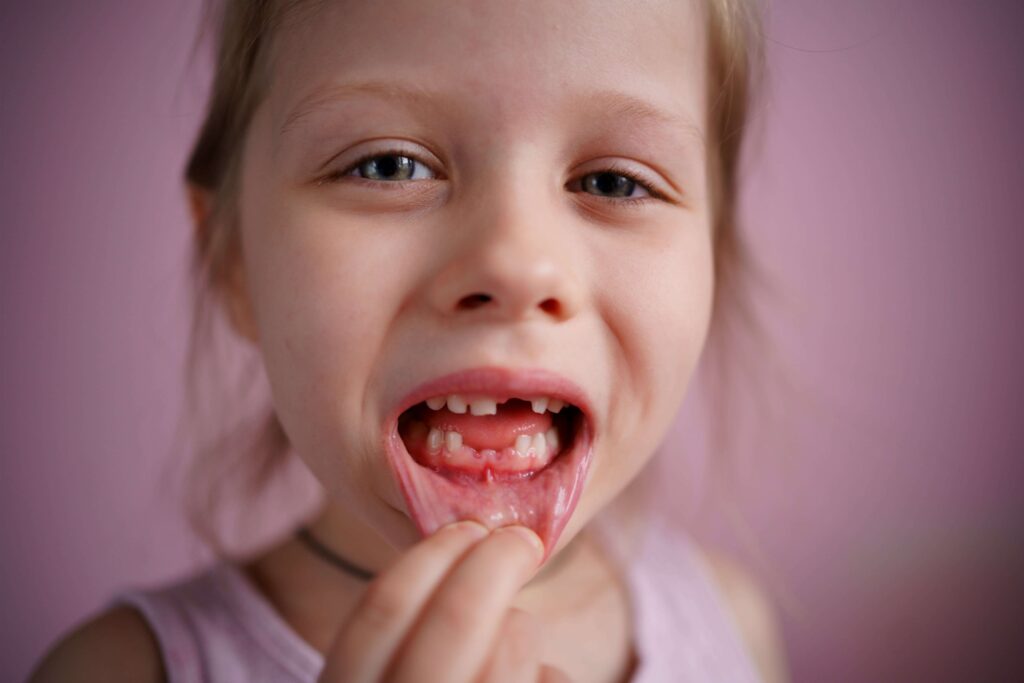 Dent de lait qui devient rose : 4 causes principales chez l'enfant 3