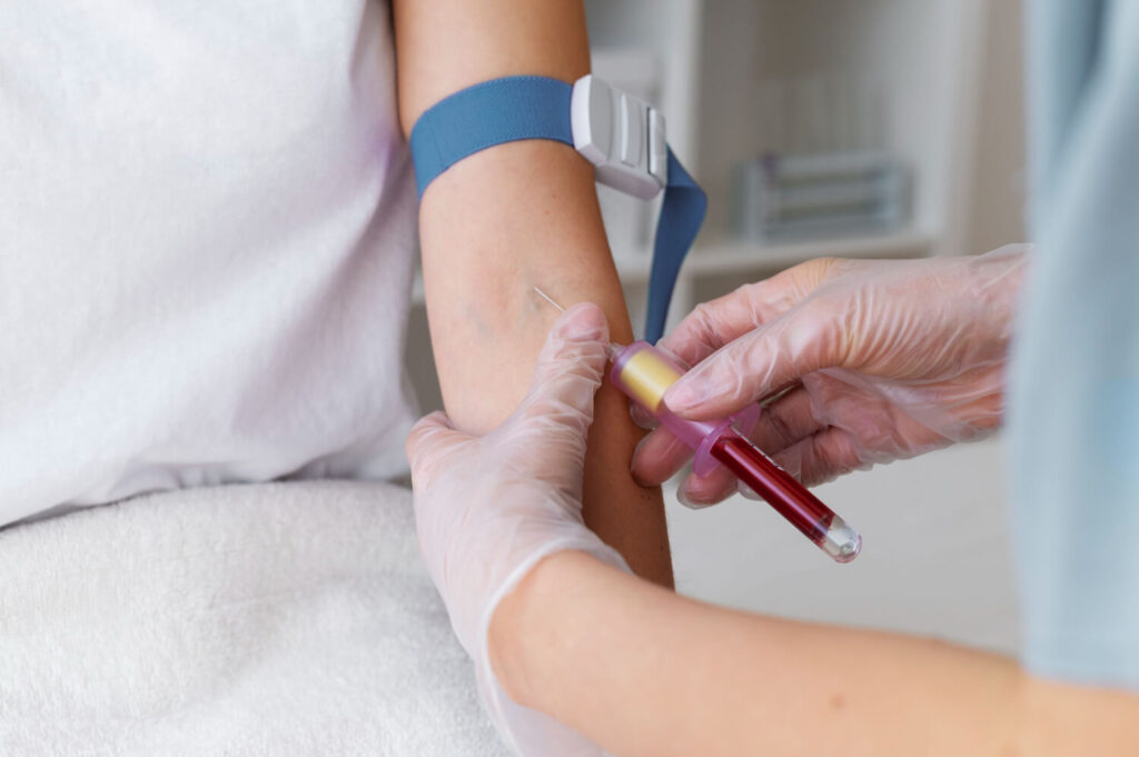 Douleur et gonflement après une prise de sang : normal ? 3