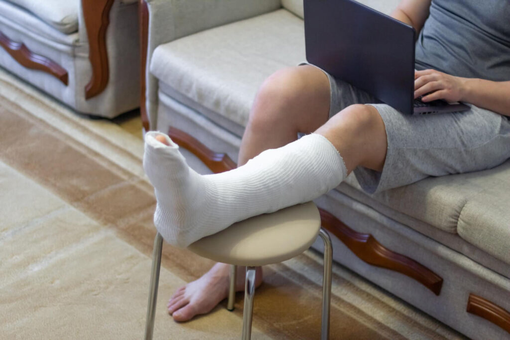 Homme avec un plâtre à la jambe