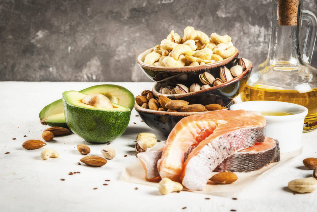 Anxiété, fatigue, spasmes : et si c'était un manque de magnésium ? 2 Gros plan sur des aliments riches en magnésium : amandes, chocolat noir, épinards et bananes.