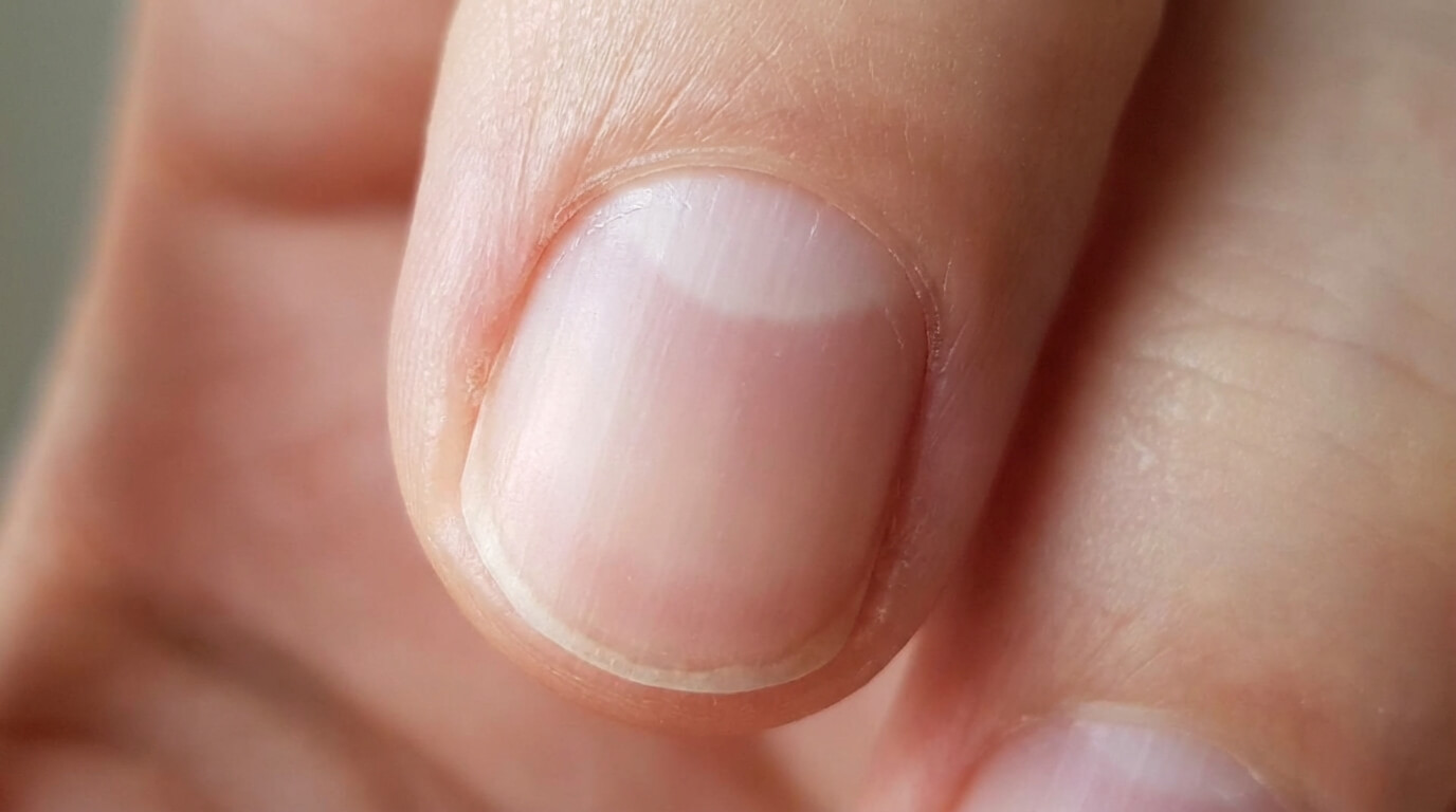 Lunule de l'ongle