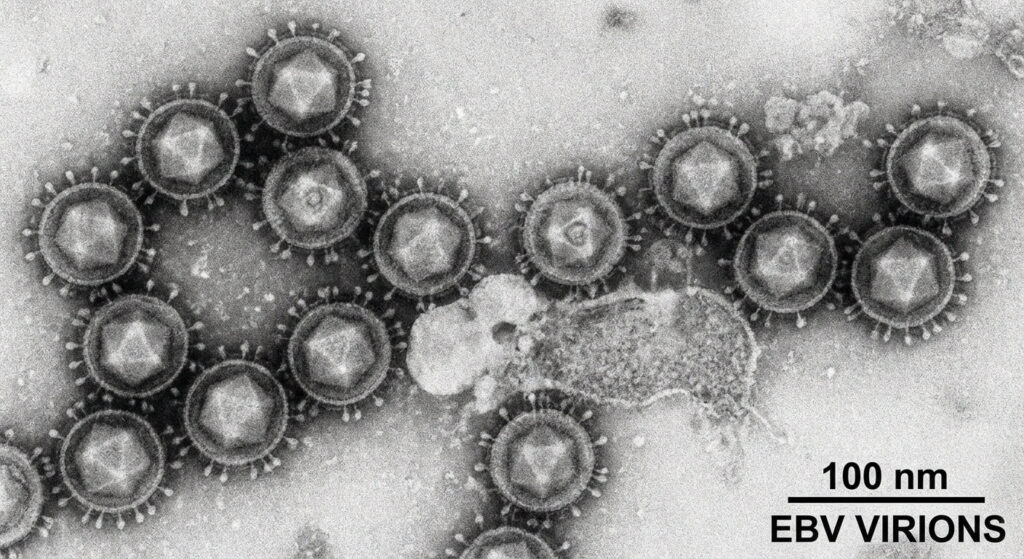 IgG anti VCA positif : comprendre vos résultats de sérologie EBV 3 Représentation microscopique du virus EBV responsable de la mononucléose