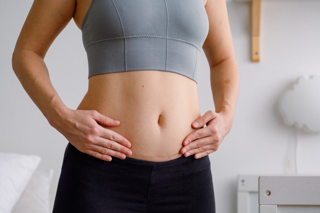 Symptômes 7 jours après Ovitrelle : ce que ressent vraiment votre corps (et pourquoi ça peut vous tromper) 3 Femme ressentant des tiraillements abdominaux suite à une stimulation ovarienne.