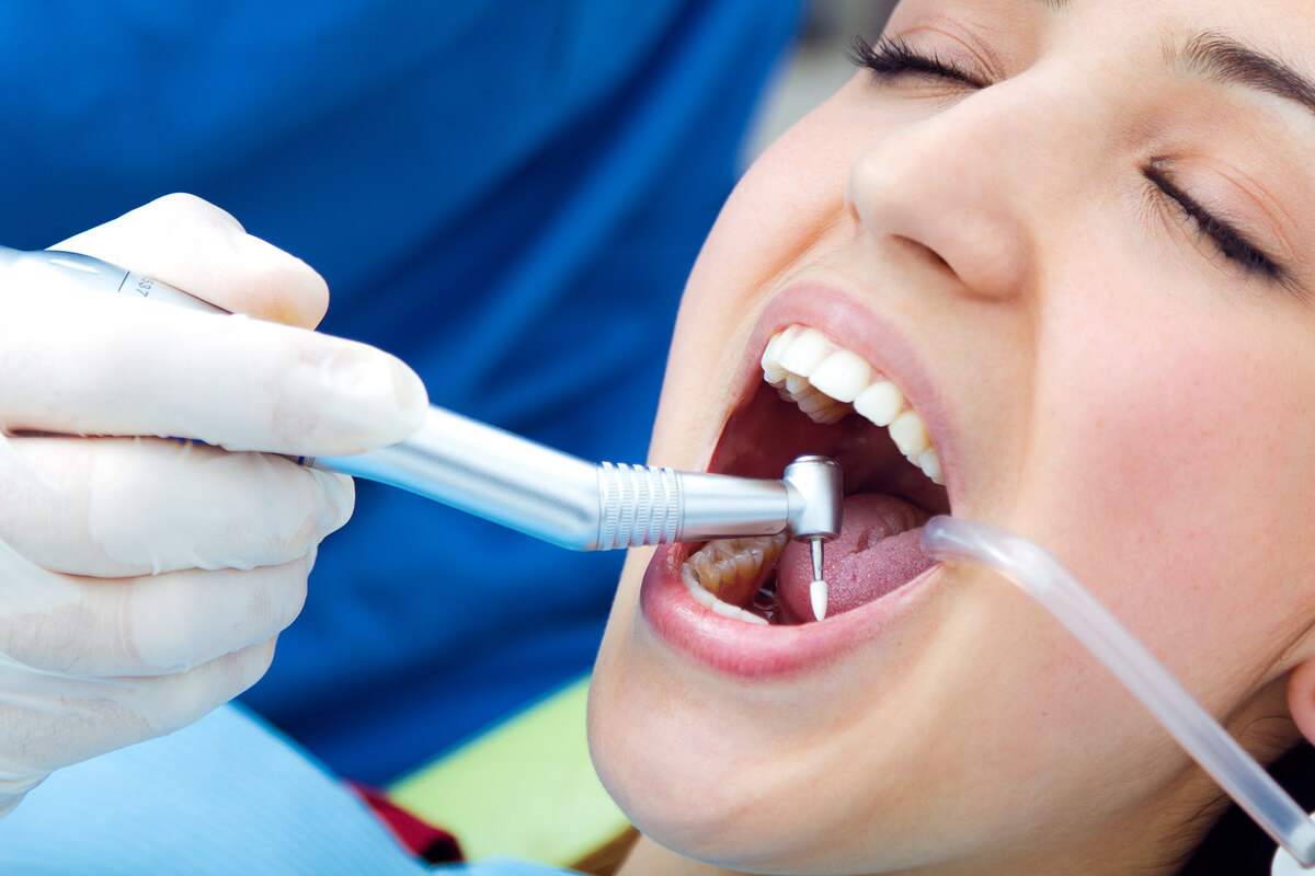 Quel est le prix pour refaire ses dents ? Guide des solutions et tarifs des soins dentaires