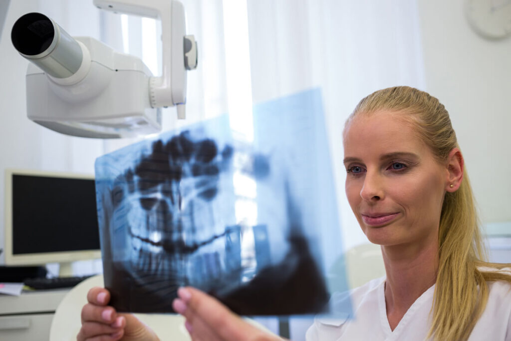 Résection apicale : témoignages, déroulement et douleurs de cette chirurgie dentaire 3 Une radiographie panoramique dentaire montrant une infection localisée au bout de la racine d'une molaire.