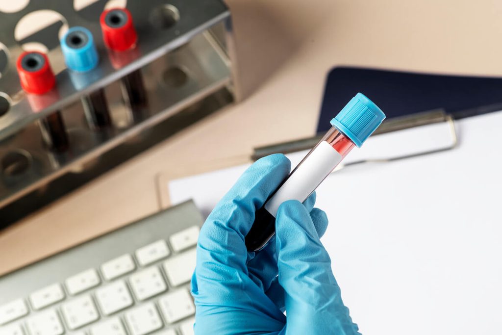 Test de grossesse Action positif : fiabilité, lecture et confirmation 3 Tube de prélèvement sanguin en laboratoire pour le dosage quantitatif des hormones de grossesse.