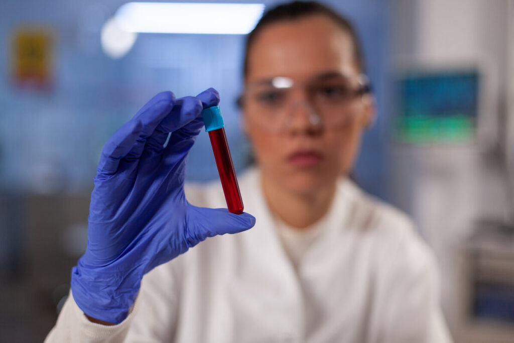 RAI positive, que faire ? Définition et risques 2 Tube de prélèvement sanguin en laboratoire pour une recherche d'agglutinines irrégulières positive.