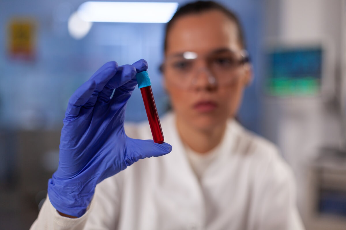 Tube de prélèvement sanguin en laboratoire pour une recherche d'agglutinines irrégulières positive.