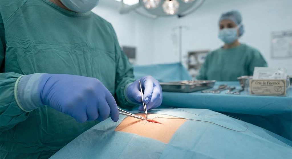 Crin de Florence : définition, origine et utilisation en chirurgie 4